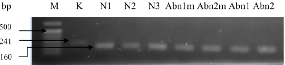 Gambar 1.  Hasil amplifikasi EgACT1. 1 = marker 1 kb; 2 = hasil amplifikasi dengan DNA genom sebagai cetakan (kontrol); 3-9 = hasil  amplifikasi dengan cDNA sampel sebagai cetakan (3 = N1; 4 = N2; 5 = N3; 6 = Abn1m; 7 = Abn2m; 8 = Abn1; 9 = Abn2)