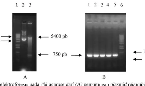 Gambar 5.   Analisis SDS-PAGE protein yang diekstraksi dari: kultur bakteri BL21(DE3)pLysS yang mengandung pET 21b-CP TICV yang diinduksi semalaman dengan IPTG 1mM  pada suhu 37 °C (In), dan tidak diinduksi (Un), MW: berat molekul protein (kDa) (Fermentas)