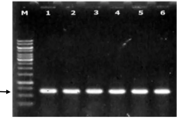Gambar 11  Hasil  PCR  terhadap  koloni  tunggal  E.  coli  rekombinan  yang  membawa plasmid pQE30-CP-PeVYV dengan primer spesifik genus  Polerovirus  F-BamHI  dan  R-PstI  (1,  2,  3,  4,  5,  dan  6);  M  adalah  marker 1 Kpb DNA ladder (Thermo Scientif