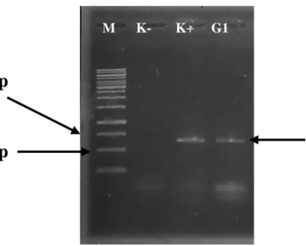 Gambar  2  Hasil  amplifikasi  gen  CP-PeVYV  berukuran  sekitar  650  bp  melalui  reverse  transcription-polymerase  chain  reaction  terhadap  sampel  tanaman  wortel  dari  Garut  (lajur  G1)  menggunakan  primer  spesifik  terhadap isolat wortel dari 