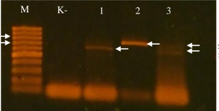 Gambar 2  Hasil amplifikasi DNA virus dengan metode  reverse transcriptation- transcriptation-polymerase chain reaction menggunakan campuran primer ToCV dan  TICV