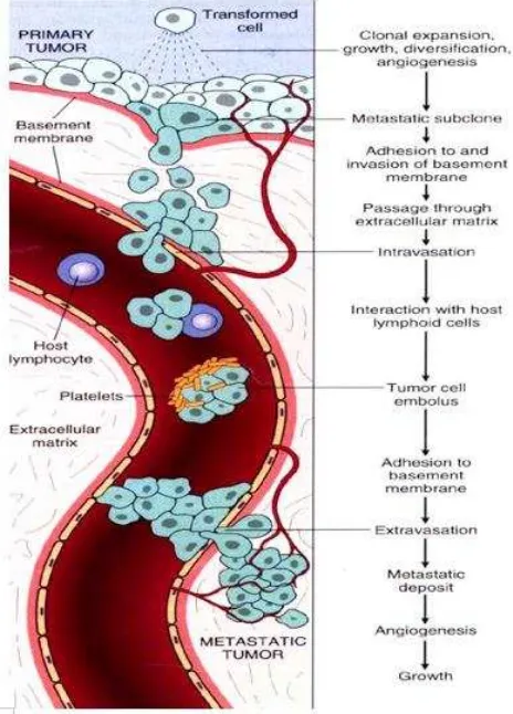 Gambar 2.1 Tahapan metastasis (Stricker and Kumar, 2010)  