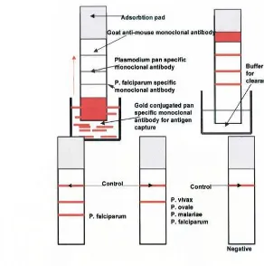 Gambar 3. Prinsip kerja Immunochromatographic Test pada malaria 
