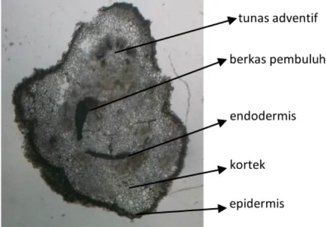 Gambar 6.   Irisan  melintang  pada  eksplan  epikotil  menunjukkan  tunas  adventif  tumbuh  secara  langsung  dari  kambium  di  antara berkas pembuluh