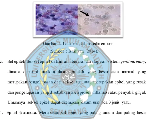 Gambar  2. Leukosit  dalam  sedimen  urin  (Sumber  :  Ismawati,  2014). 