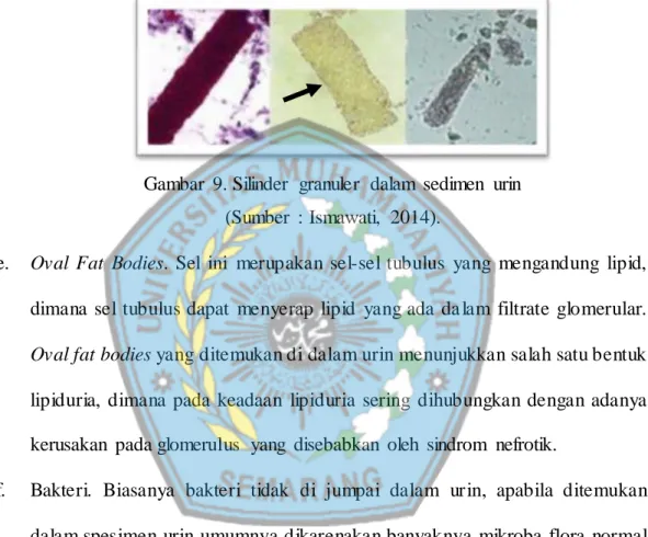 Gambar  9. Silinder  granuler  dalam  sedimen  urin      (Sumber  :  Ismawati,  2014)