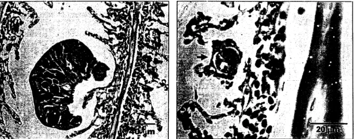 Gambar  3.  Parasit  Ivtonogenea  (gambar  kin)  pada  insang.  Terjadi  edema.  Pada  gambar  kanan  tampak  Myxospora  plasmodia  cii  epitel  antara  lamela  insang  (panah  hitam)