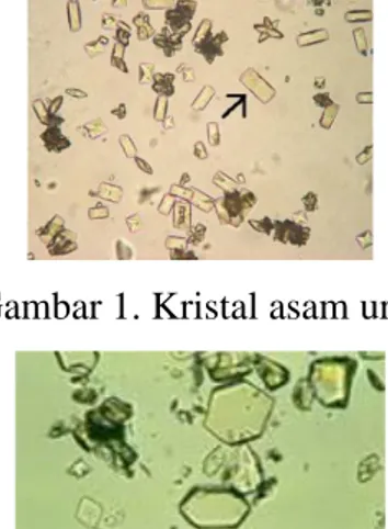 Gambar 1. Kristal asam urat 