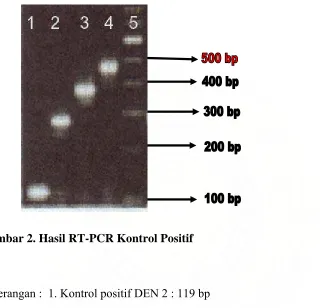 Gambar 2. Hasil RT-PCR Kontrol Positif 