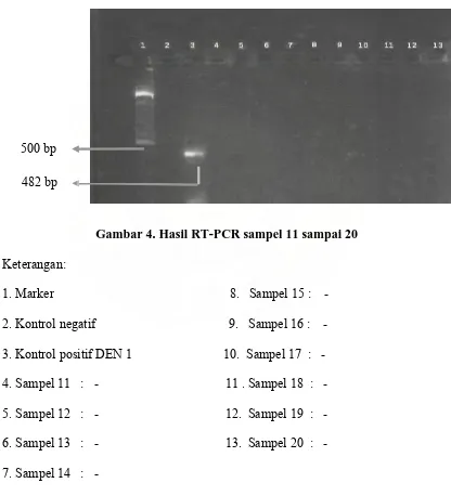 Gambar 4. Hasil RT-PCR sampel 11 sampai 20 