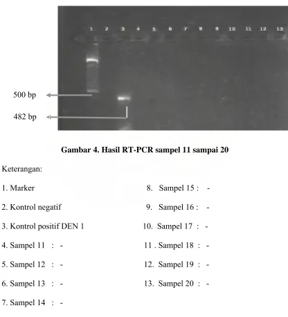 Gambar 4. Hasil RT-PCR sampel 11 sampai 20 