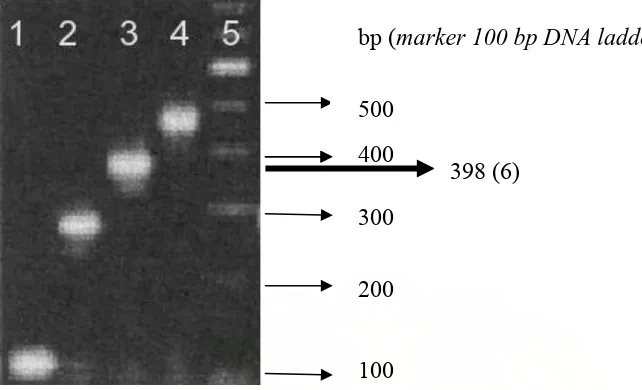 Gambar 2. Hasil Kontrol positif RT-PCR dari Keseluruhan Serotipe Virus                      Dengue 
