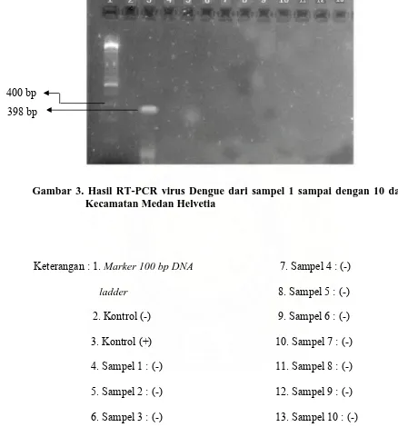 Gambar 3 menunjukkan hasil RT-PCR sampel virus Dengue dari nomor 1 
