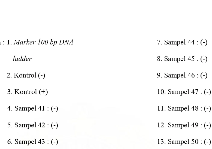 Gambar 8. Hasil RT-PCR dari virus Dengue dari sampel 51 sampai dengan 60 dari Kecamatan Medan Selayang 