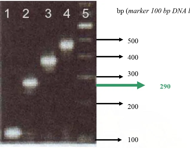 Gambar 4.  Kontrol positif hasil RT-PCR dari seluruh Serotipe Virus Dengue        Keterangan :  1