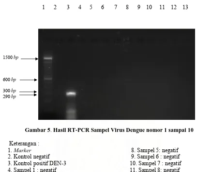 Gambar 5. Hasil RT-PCR Sampel Virus Dengue nomor 1 sampai 10 