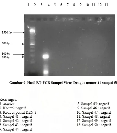 Gambar 9. Hasil RT-PCR Sampel Virus Dengue nomor 41 sampai 50 