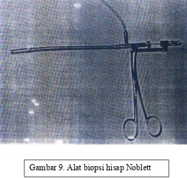 Gambar 9. Alat biopsi hisap Noblett 
