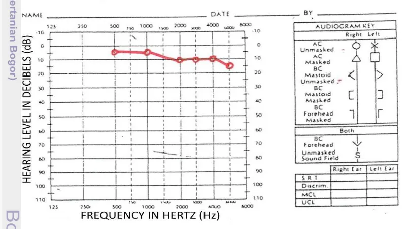 Gambar 6  Grafik audiogram subjek pendengaran normal 