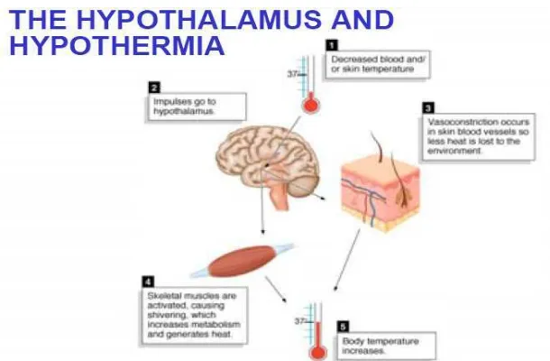 Gambar 2.2. Hubungan hipotermia dan hipotalamus.  