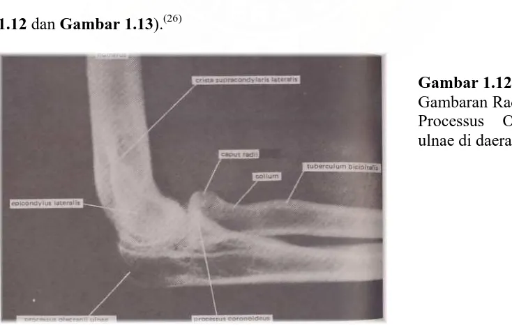 Gambar 1.12: (26)  Gambaran Radiologis 