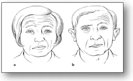 Gambar  3.  Perbandingan  Penampilan  klinis  pasien    dengan  lesi  sentral  (a)  dan   perifer   (b)