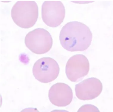 Gambar 2.3. Bentuk Plasmodium Vivax [9] 