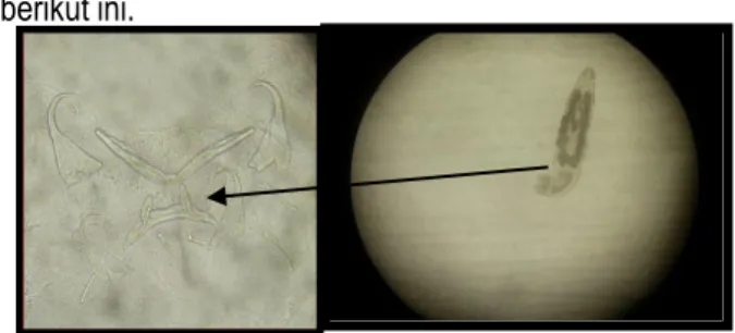 Gambar 2. Parasit Chichlidogyrus sp. 