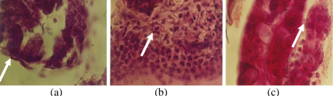 Gambar 3. Eosinofilik Hipertropi dan Inclusion Bodies pada Organ Hepatopankreas (a), Usus (b) dan Insang (c) Udang yang Terserang WSSV.