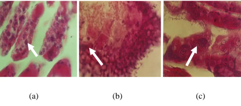 Gambar 1. Eosinofilik Hipertropi dan Occlusion Bodies Sel-Sel Insang (a), Hepatopankreas (b), Usus (c) Udang yang Terserang MBV.