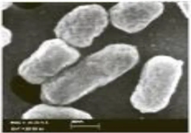 Gambar 7. Struktur morfologi bakteri Escherichia coli  (http://id.wikipedia.org/wiki/Escherichia coli)  Dalam taksonomi mikrobiologi, kedudukan Escherichia coli adalah: 