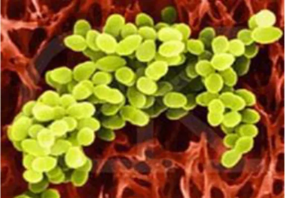 Gambar 8. Gambar Staphylococcus aureus  ((http://id.wikipedia.org/wiki/staphylococcus) 