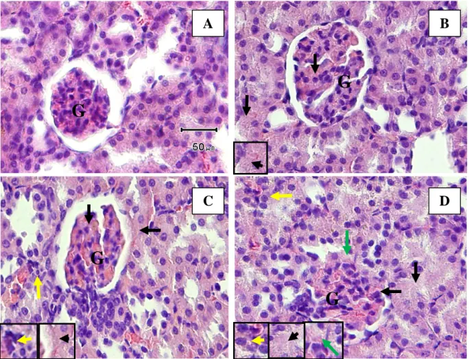 Gambar 1 Gambaran histopatologi ginjal tikus renal fibrosis (Perbesaran 400x).  