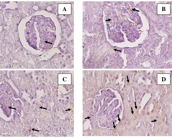 Gambar 2 Gambaran immunohistokimia IL-1β ginjal tikus induksi streptokinase, 400x.  