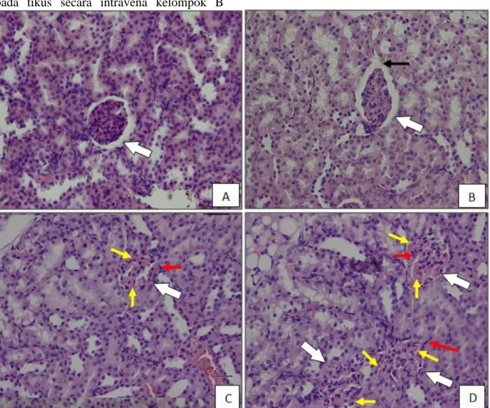 Gambar  2. Histopatologi  ginjal  tikus  induksi  streptokinase  dengan  pewarnaan  HE(Perbesaran  400x).