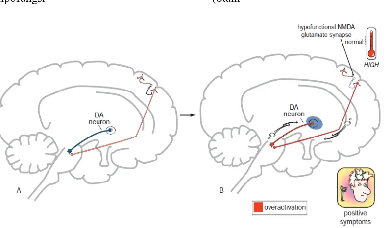 Gambar 5. Hipofungsi NMDA di kortek yang dihubungkan dengan gejala positif pada skizofrenia (Stahl, 2013)