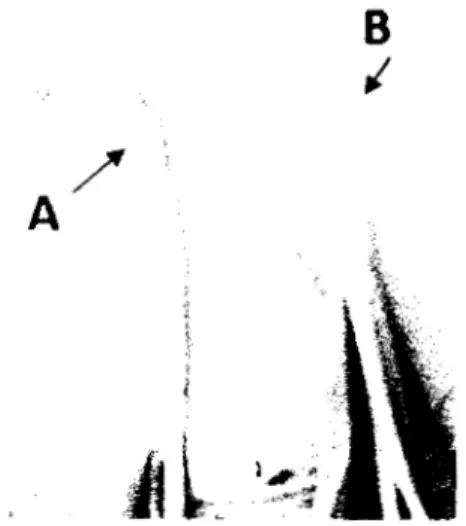 Gambar 2.  Pelepah daun bawang merah bagian luar menunjukkan gejala nekrotik (A),  Pelepah daun bagian dalam sebagai  sumber inokulum (B)