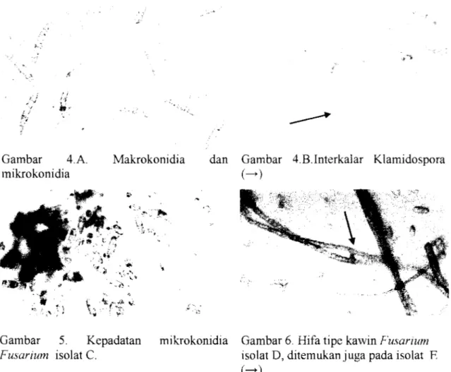 Gambar  4.A.  Makrokonidia  dan  Gambar  4.B.Interkalar  Klamidospora 