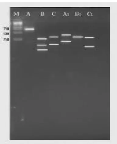 Gambar 2: Elektroforesis ITS-RFLP dengan enzim  Msp I (isolat A, B, dan C) dan enzim Hinf I ( isolatA, B, dan C) pada gel agarose 3%, M=Marker berukuran 1 Kb