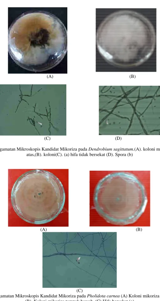 Gambar 3. Pengamatan Mikroskopis Kandidat Mikoriza pada Pholidota carnea (A) Koloni mikoriza tampak atas dan  (B)