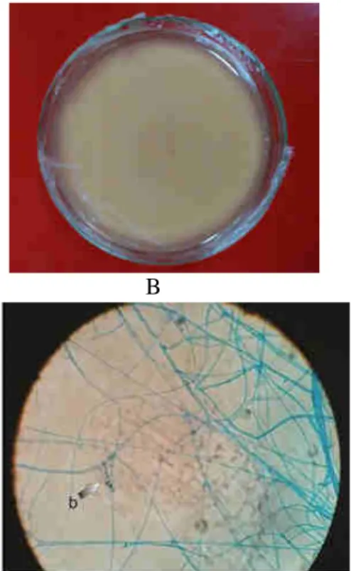 Gambar 7. Pengamatan Mikroskopis Kandidat Mikoriza pada Dendrobium mutabile (A). koloni mikoriza tampak atas,  (B).koloni mikoriza tampak bawah, (C)