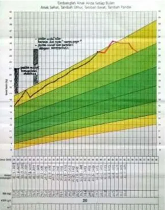 Gambar 2. Grafik Pertumbuhan An. N Pada KMS Usia  25 – 51 Bulan 