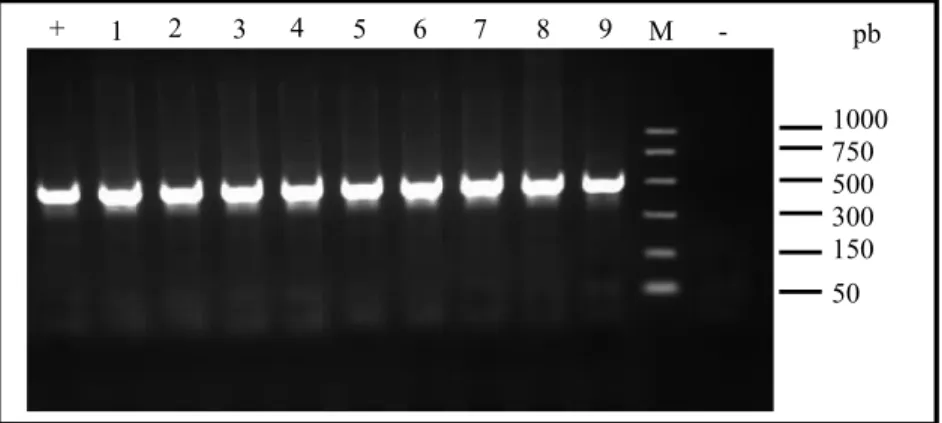 Gambar 1.  Hasil elektroforesis produk PCR dengan primer CB3FC-NINFA pada gel agarosa 1,5% yang mengandung etidium  bromida (10µg/µl)