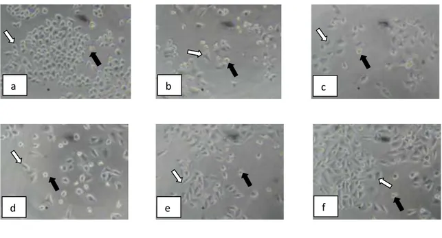 Gambar 7. Morfologi Sel HeLa: (a) Tanpa Perlakuan (kontrol sel) dan dengan Perlakuan  Doxorubicin Konsentrasi : (b) 5 M, (c)   2,5 M, (d) 1  M, (e) 0,5 M,(f)   dan  0,25  M
