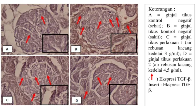 Gambar  1.  Ekspresi  Transforming  Growth  Factor-β  (TGF-β)  pada  Hewan  Model  Fibrosis  Ginjal yang Diinduksi Streptokinase (Perbesaran 1000x) 