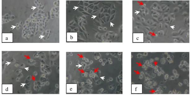 Gambar 7.   Morfologi sel HeLa : (a) tanpa Perlakuan (kontrol sel) dan dengan  perlakuan Doksorubisin konsentrasi : (b) 0,625 M, (c)  1,25 M,  (d)  2,5  M,  (e)  5  M,  (f)    dan  10  M