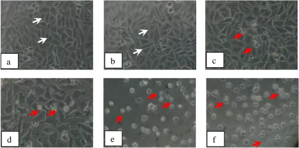 Gambar  12.  Morfologi  sel  T47D:  (a)  tanpa  perlakuan  (kontrol  sel)  dan  dengan  perlakuan senyawa 1-(4’-bromofenil)  -3-(4-hidroksi-3-metoksifenil)-2-propen-1-on,  konsentrasi  :  (b)  5  M,  (c)   10  M,  (d)  20  M,  (e)   40 M,(f)  dan 60 M
