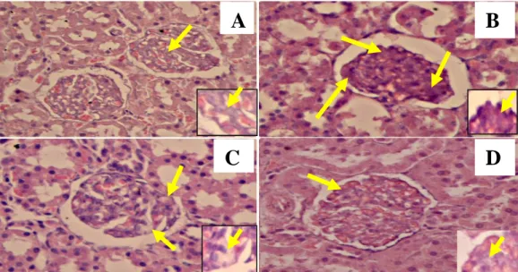 Gambar 2 Histopatolgi ginjal tikus model fibrosis ginjal hasil induksi streptokinase dan telah diterapi  kacang kedelai (perbesaran 400x)
