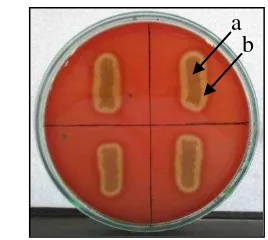 Figure 2  Bacillus pumilus isolate on blood agar (a); �-haemolytic zone (b).  
