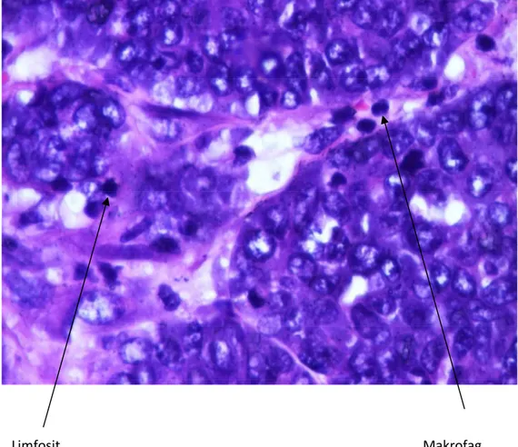 Gambar  10 : Sebukan limfosit dan makrofag pada kelompok perlakuan  P2                       (Pembesaran 400 X)           